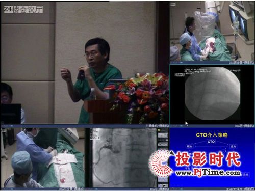 ��(z��i)���h(yu��n)���{(di��o)�ؽ��O(sh��)˼· AVA�ֲ�ʽ䛲�ϵ�y(t��ng)��������(y��ng)��ָ�]�ϵđ�(y��ng)��