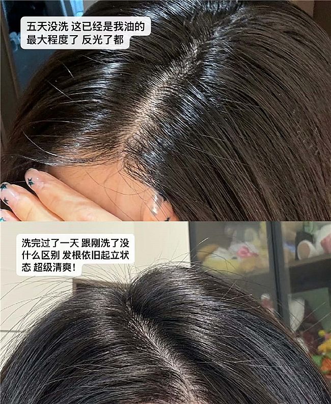 2026���]:��ôȥ���^�ϵ��^Ƥм��ϴ�^��ȥмֹ�W�����Ă���