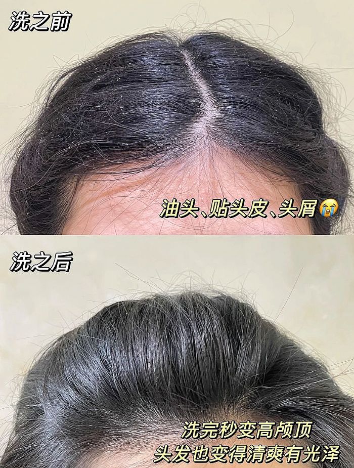 ȫ���m�õ�ȥм����ϴ�l(f��)ˮ�x�Ă�(g��)��2026ȫ���g�οڱ�֮��������С���^�l(f��)���Ͷ����Ŀ�����ģ�